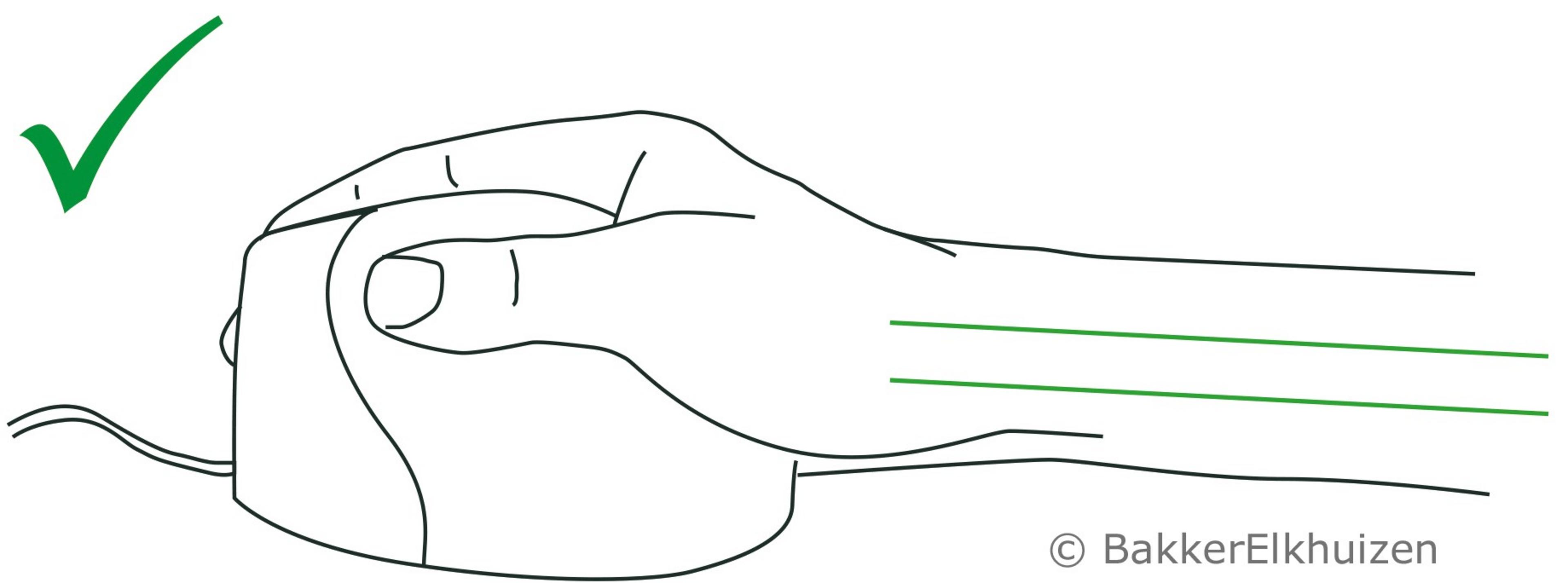Bakker Evoluent 4 Vertikalmaus rechts