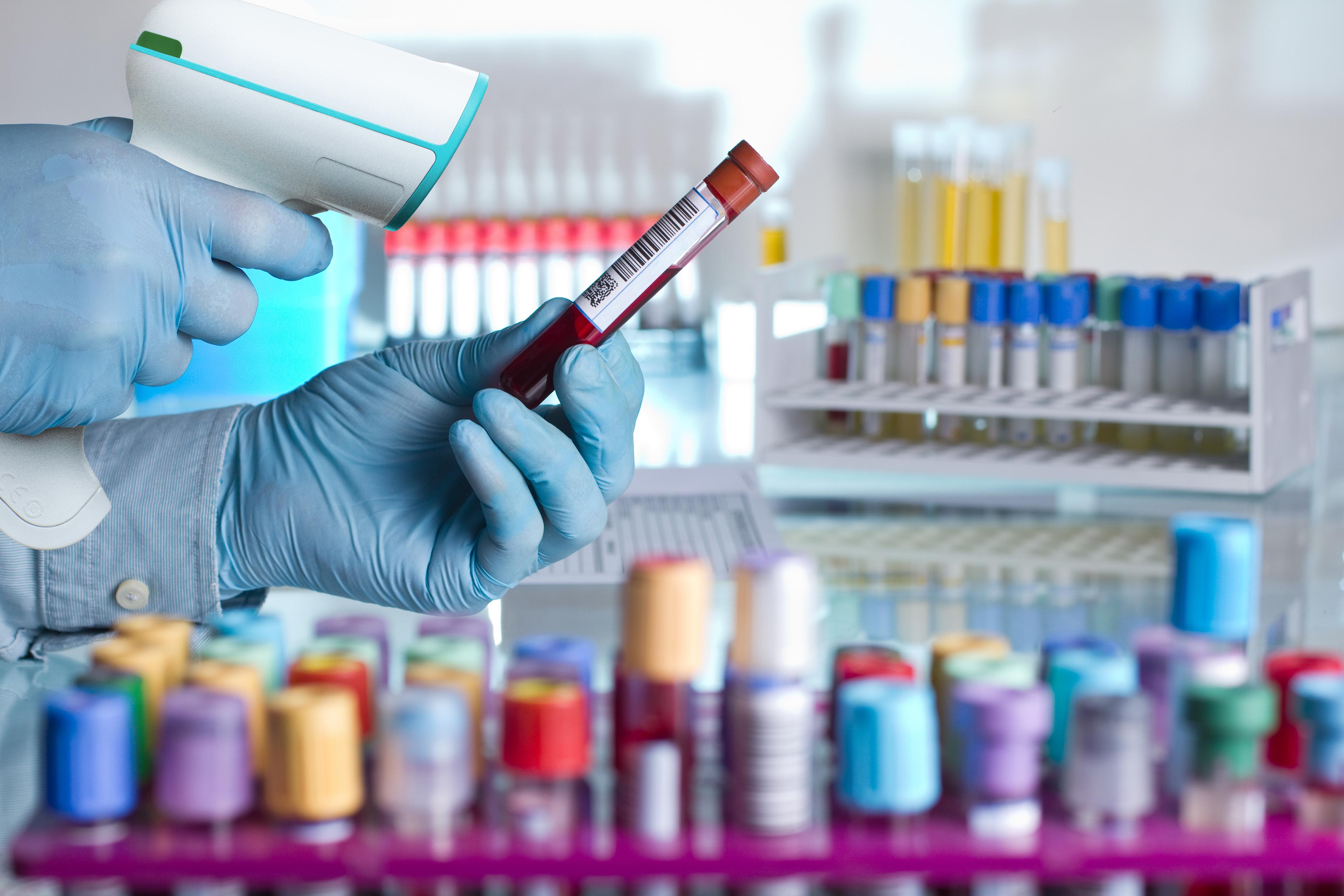 Honeywell Xenon Ultra 1960h HD HC Kit